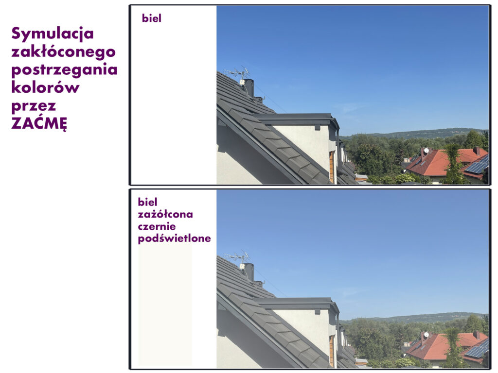Opis i symulacja widzenia okiem z zaćmą i po zabiegu wymiany soczewki
